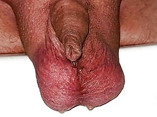 Small Forskin Cock Pisses