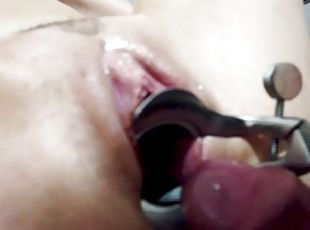 Young pussy speculum creampie
